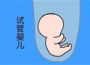 培养南宁捐卵宝宝艺术细胞的小技巧